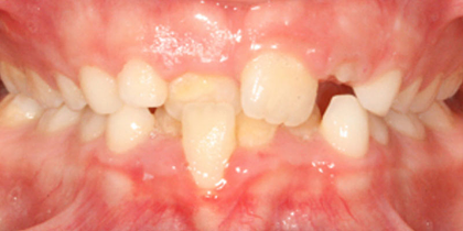 Case 1 - Before