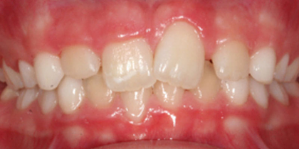 Case 1 - After