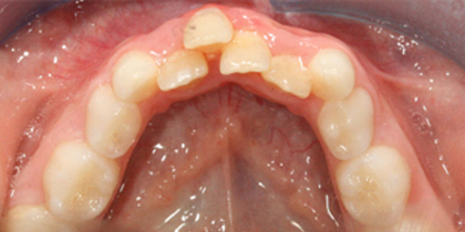 Case 2 - Before