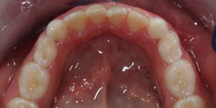 Case 2 - After