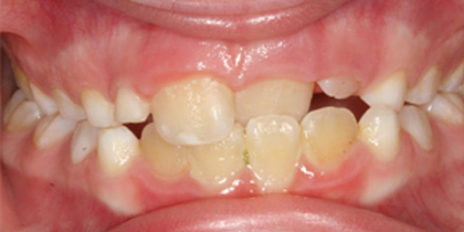 Case 3 - Before