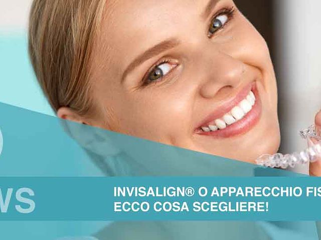 Invisalign® o apparecchio fisso? Ecco cosa scegliere!