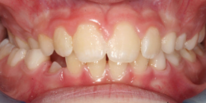 Case 1 - Before