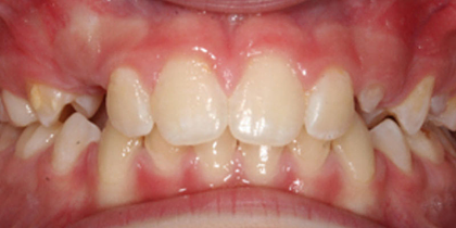 Case 1 - After