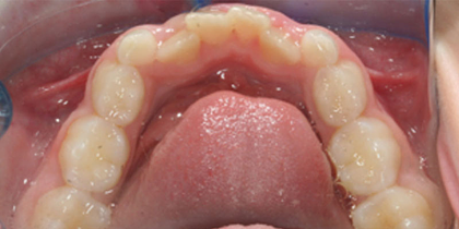 Case 2 - Before