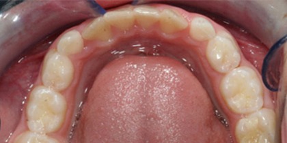 Case 2 - After