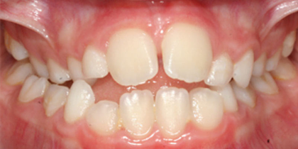 Case 3 - Before